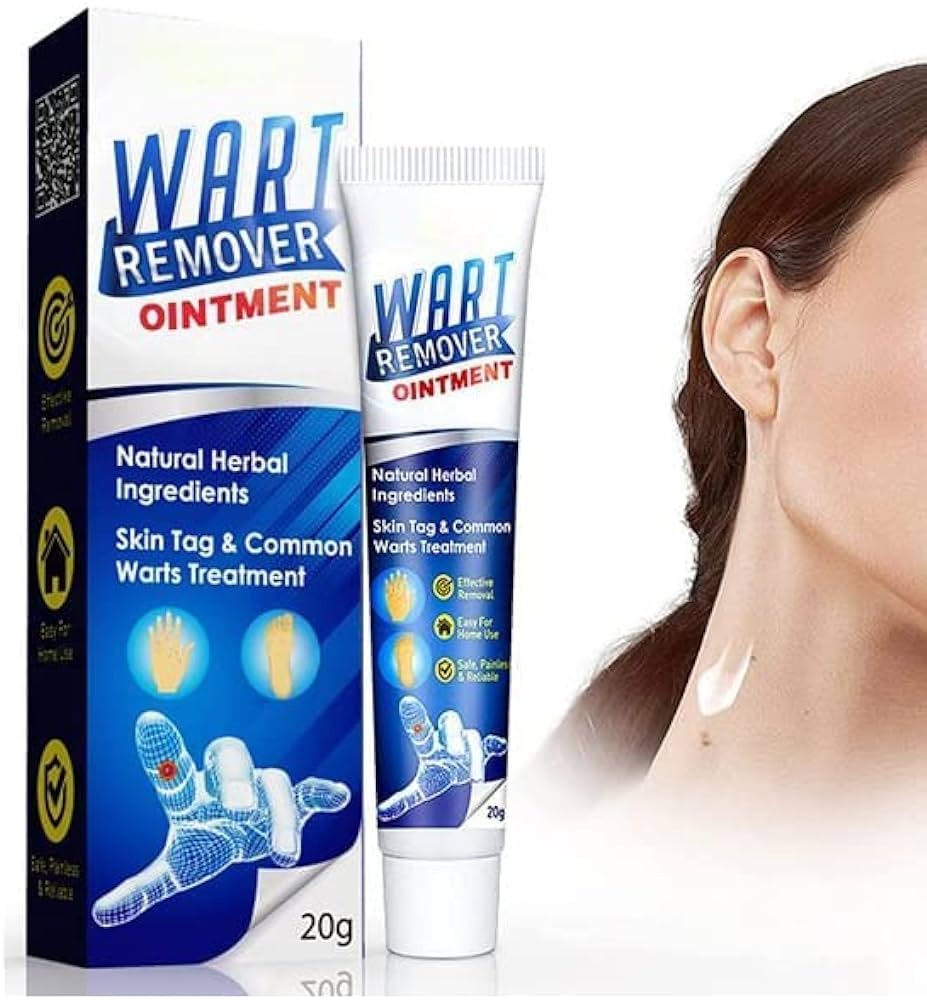 Wart remover ointment for wart removal