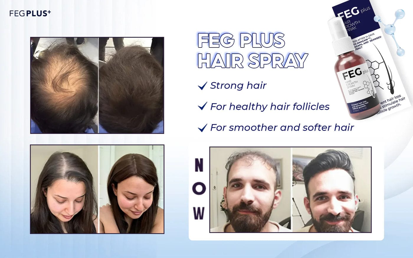 FEG Plus Hair Growth Spray Original-USA